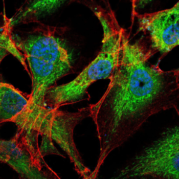 IRAK3 Antibody