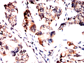 IRAK3 Antibody