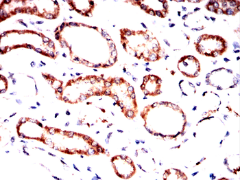 HMMR Antibody