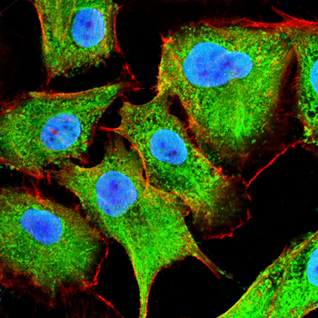 CDH17 Antibody
