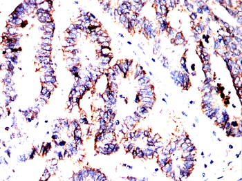 CDH17 Antibody