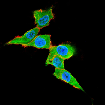 CDH17 Antibody