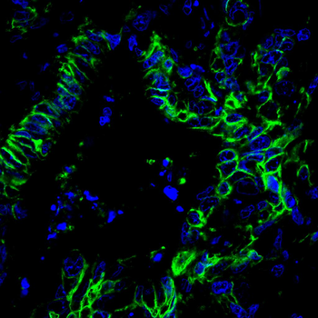 CDH17 Antibody