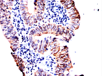 CDH17 Antibody