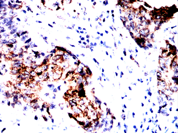 CDH17 Antibody