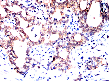 WTAP Antibody