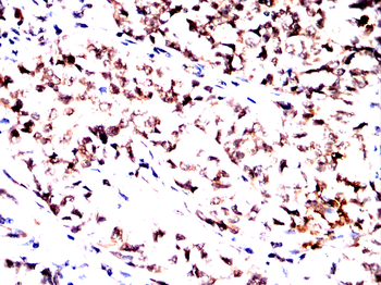 PDPK1 Antibody