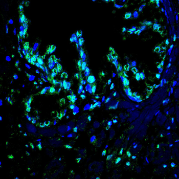 CBX1 Antibody