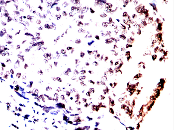 CBX1 Antibody