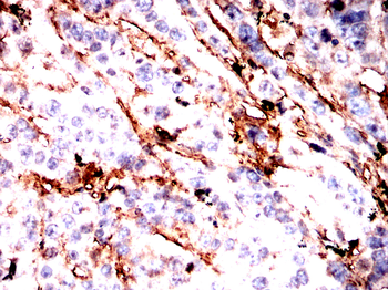FN1 Antibody