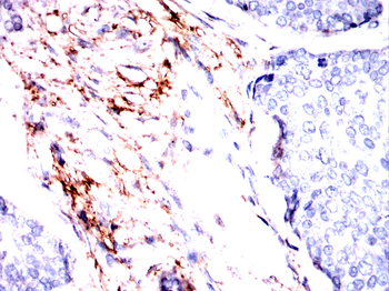 FN1 Antibody