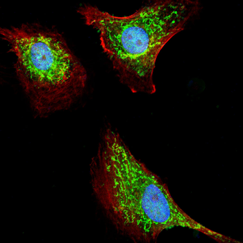 FN1 Antibody