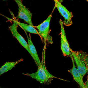 PI 3 Kinase p55 Rabbit Polyclonal Antibody