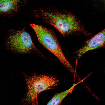 PI 3 Kinase p55 Rabbit Polyclonal Antibody