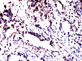 CALR Antibody