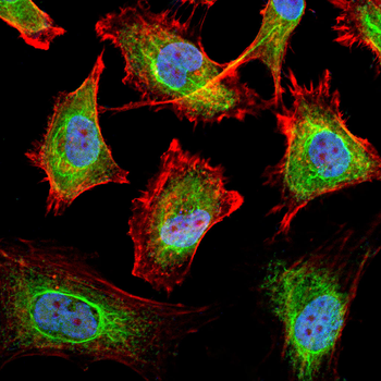 CALR Antibody