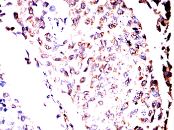 PLCG1 Antibody