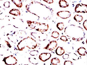 PLCG1 Antibody