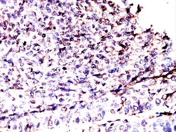 PLCG1 Antibody