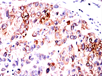 CALCA Antibody