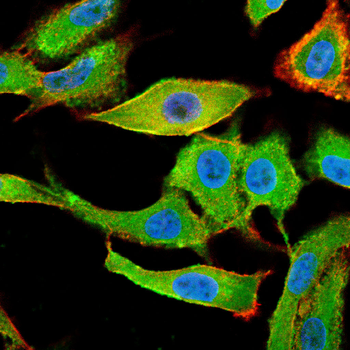 LCN2 Antibody