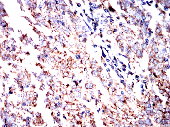LCN2 Antibody