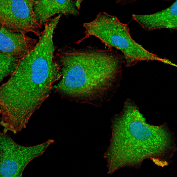 KDR Antibody