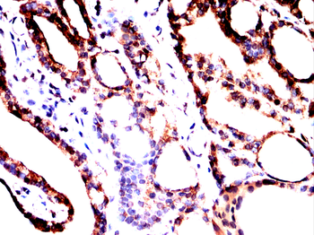 NF2 Antibody