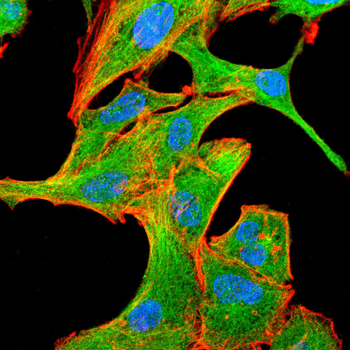 SSTR2 Antibody