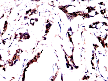 SEPTIN2 Antibody