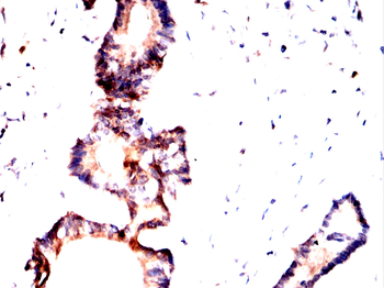PRMT7 Antibody