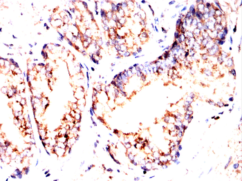 PRMT7 Antibody