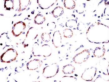 PRDX3 Antibody