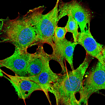 UCP1 Rabbit Polyclonal Antibody