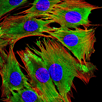CLPP Antibody