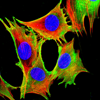FLT1 Antibody