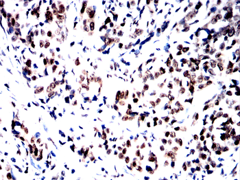 RARA Antibody