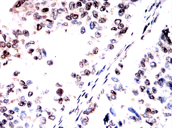 RARA Antibody
