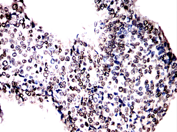 RARA Antibody