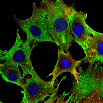 CRABP1 Antibody