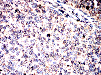 CRABP1 Antibody