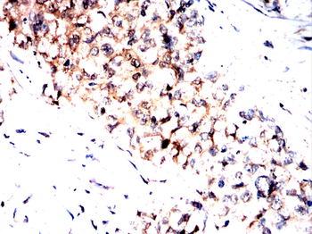 CRABP1 Antibody