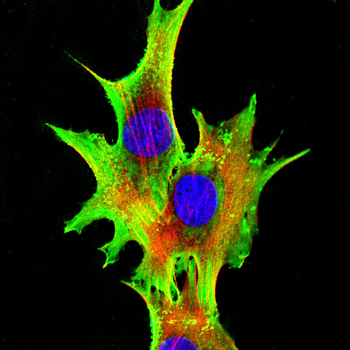TREM2 Antibody