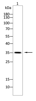 TREM2 Antibody