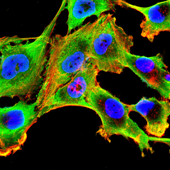 TREM2 Antibody