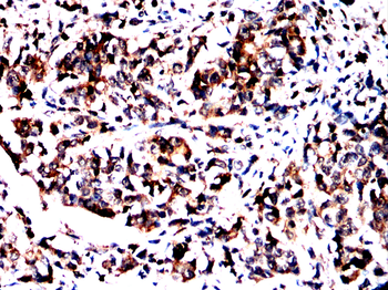 ANXA6 Antibody