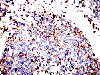 ANXA6 Antibody