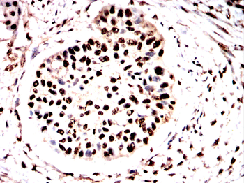 FOXM1 Antibody