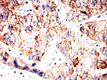 FGFR4 Antibody