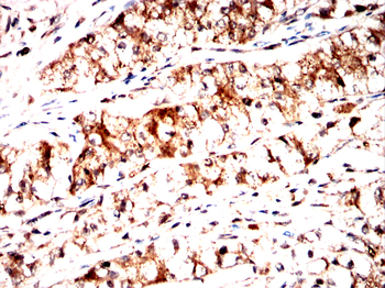 FGFR4 Antibody
